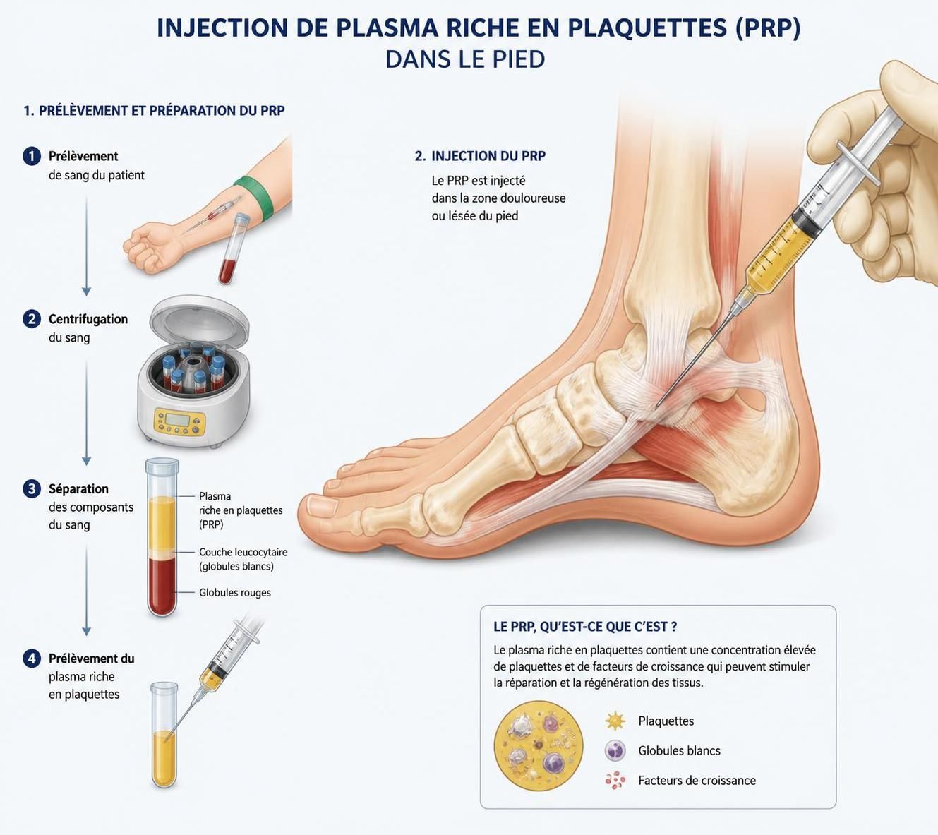 découvrez les causes courantes de la douleur à la plante des pieds et les solutions efficaces pour soulager et prévenir cet inconfort au quotidien.