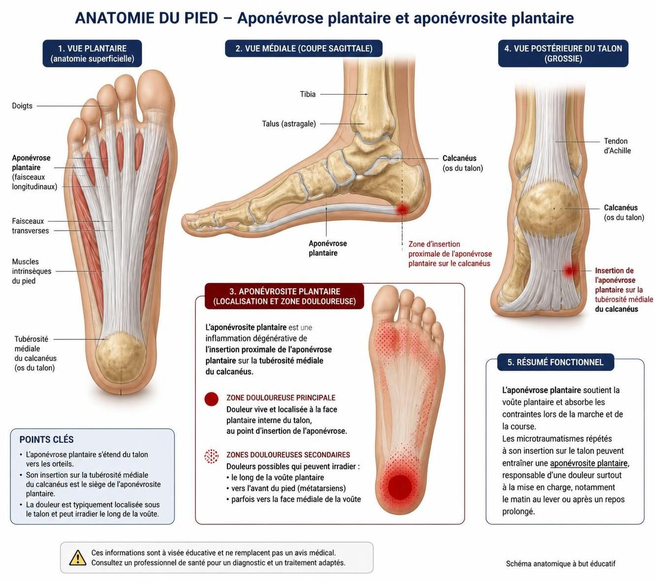 découvrez pourquoi l'aponévrosite plantaire peut persister et apprenez les méthodes efficaces pour soulager la douleur et favoriser la guérison.