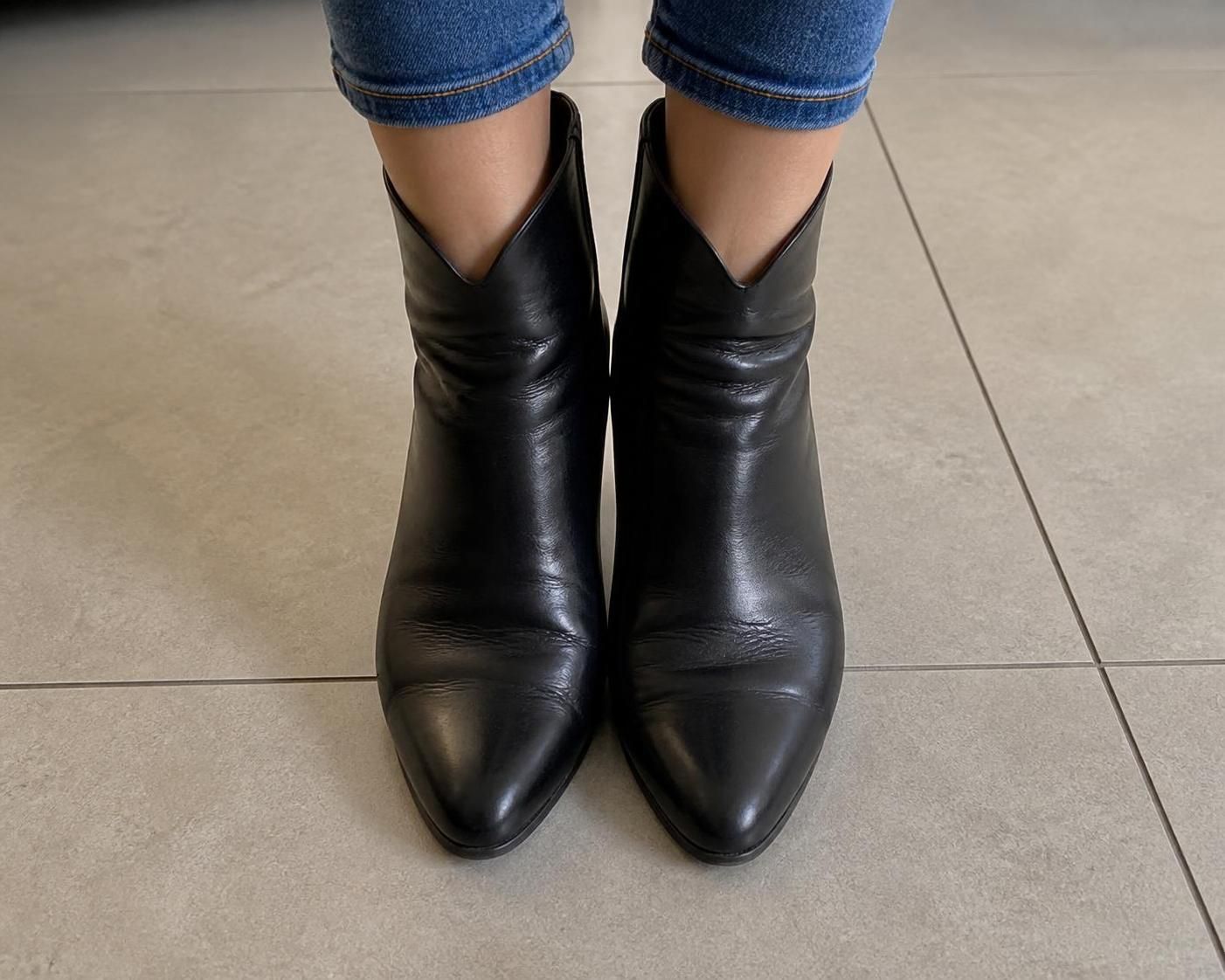 découvrez les causes, symptômes et traitements efficaces de la douleur du nerf sural au pied pour mieux comprendre et soulager cet inconfort.